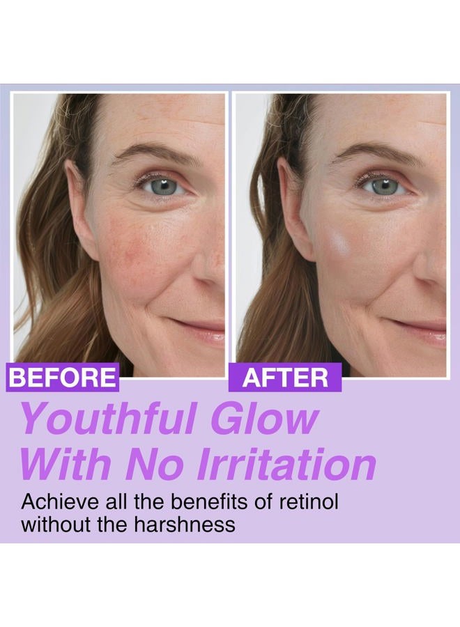CELDYQUE Korean Bakuchiol Concentrate Mix-in Serum 30,000 ppm - High Potency Retinol Alternative | Wrinkle Reduction Skin Firming & Smoothing - Anti-Aging Sensitive Skin Vegan & Cruelty-Free Non-GMO 2 oz - Image 4
